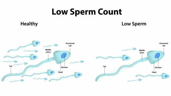 Is 40 million considered low sperm count